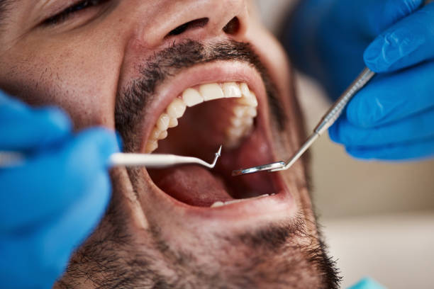 Best Emergency Treatment for Dental Infections or Abscesses in Viola, NY